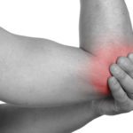 Tennis and Golfers Elbow Epicondylitis